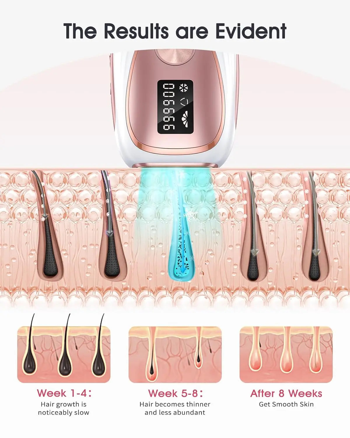 JOOYEE Electric Epilator – Safe, Painless, and Effective Hair Removal for Men & Women c9f98b-b7.myshopify.com