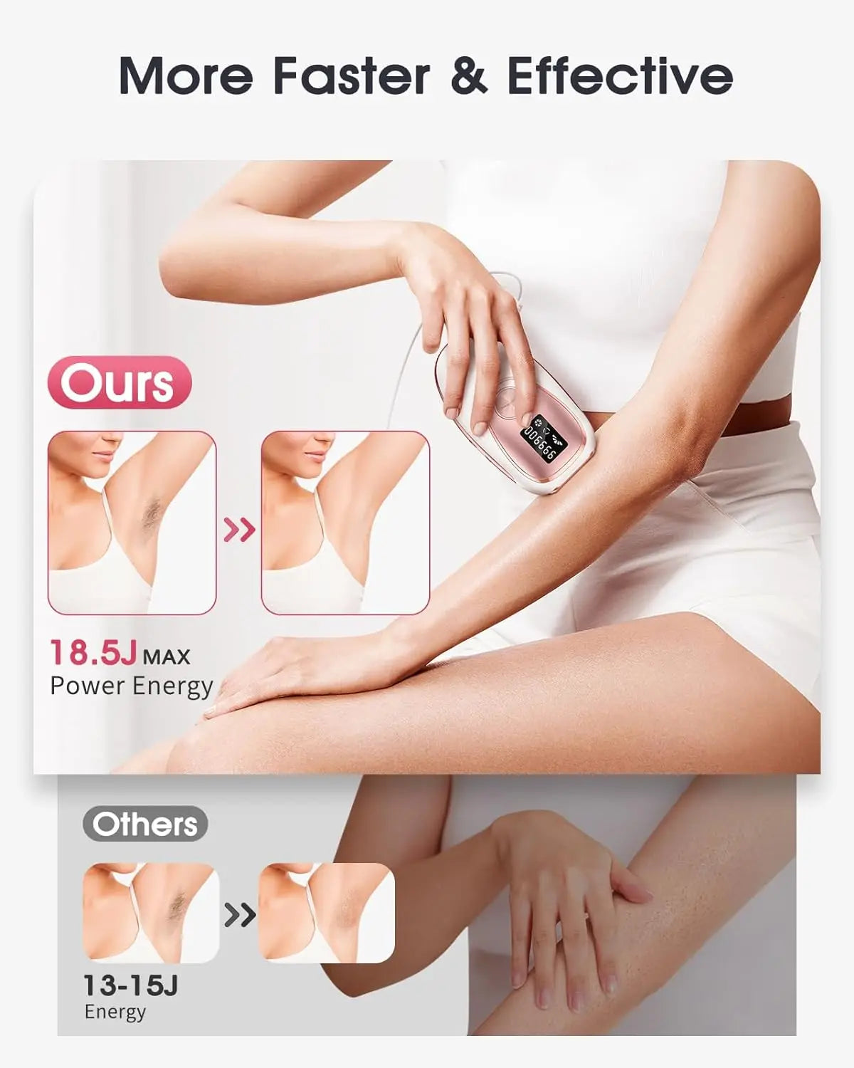 JOOYEE Electric Epilator – Safe, Painless, and Effective Hair Removal for Men & Women c9f98b-b7.myshopify.com