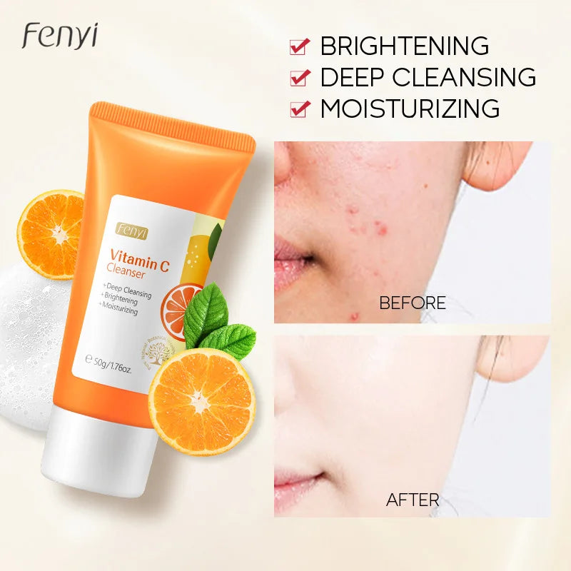 Vitamin C Facial Cleanser – Hydrating & Deep-Cleansing Face Wash for Acne, Blackhead Removal, and Skincare c9f98b-b7.myshopify.com