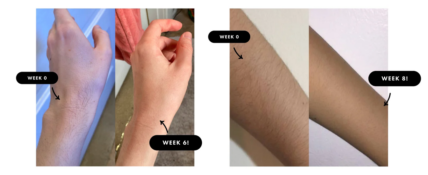 JOOYEE Electric Epilator – Safe, Painless, and Effective Hair Removal for Men & Women c9f98b-b7.myshopify.com