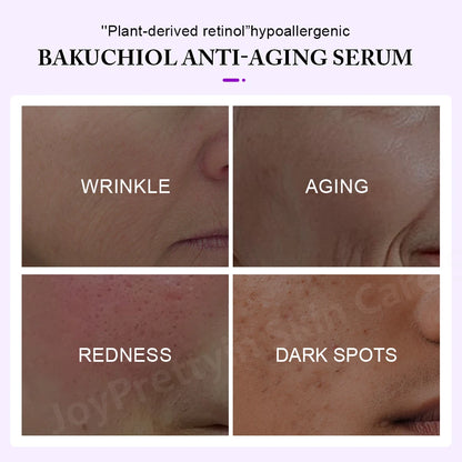 Plant Retinol Face Serum Wrinkle Removal Hyaluronic Acid Lifting Moisturizing Skin Care Niacinamide Facial Serum Skincare c9f98b-b7.myshopify.com