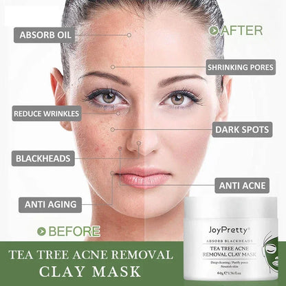 Green Tea Tree Clay Mask Facial Cleans Cream Black Dots Blackheads Remove Mask Against Acne Treatment Cream Sleep Mask Skin Care c9f98b-b7.myshopify.com